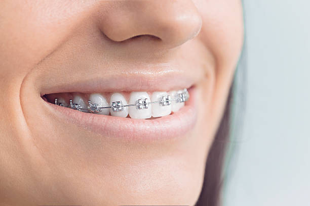 Best Invisalign and Clear Aligners  in , FL
